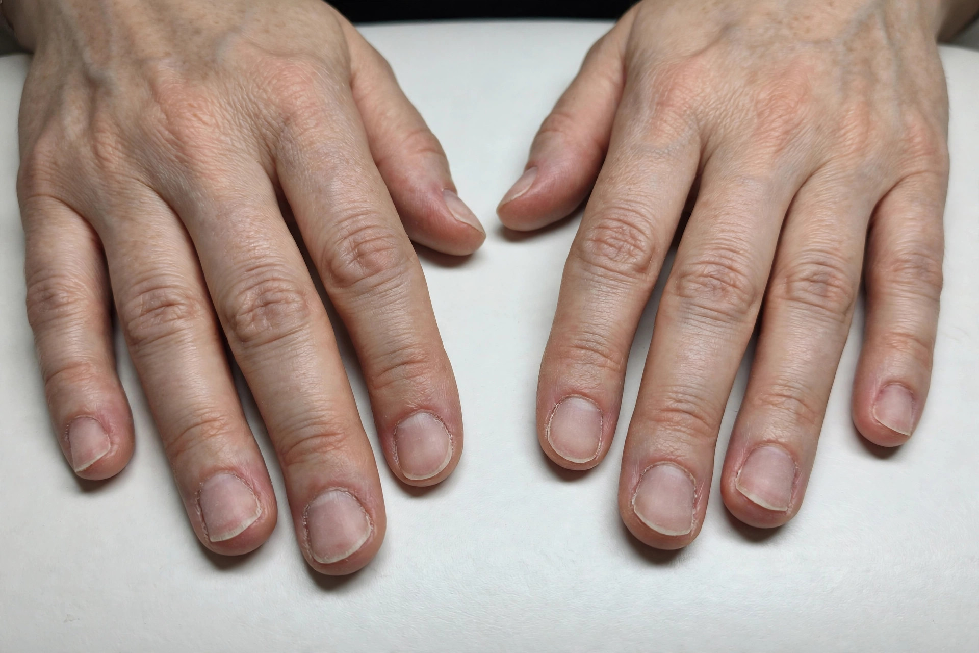 Hands with plain unpolished nails before manicure